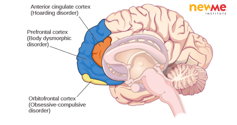 Các vùng khác nhau của não có thể liên quan đến các rối loạn tâm lý khác nhau.